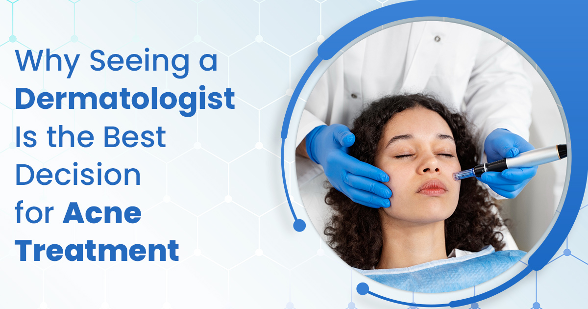 Why Seeing a Dermatologist Is the Best Decision for Acne Treatment